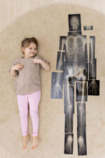 Žmogaus skeletas rentgeno nuotraukoje 350075 - Image 3